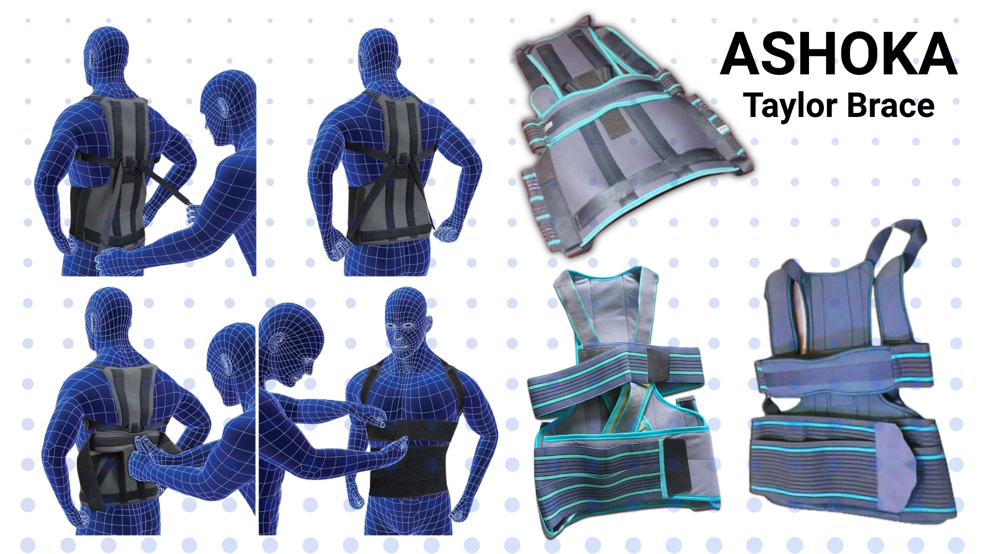 Ashoka Taylor Brace, Image of www.aleefsurgical.com