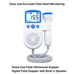 Fetal Doppler - Heart Monitoring image of www.aleefsurgical.com